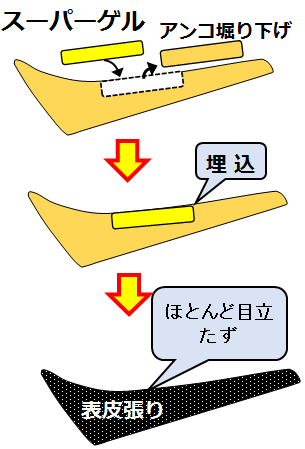 スーパーゲル解説図